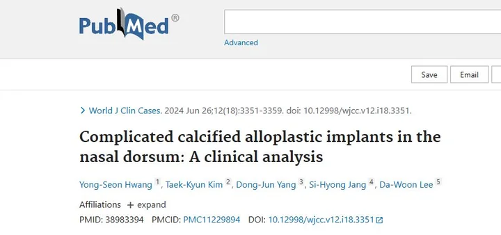 Complicated calcified alloplastic implants in the nasal dorsum: A clinical analysis 학술활동 이미지