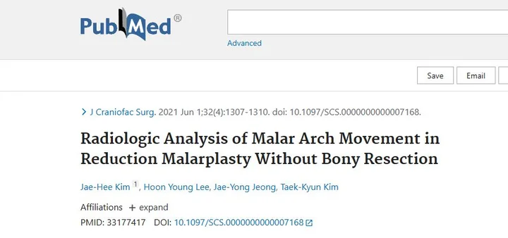 Radiologic Analysis of Malar Arch Movement in Reduction Malarplasty Without Bony Resection 학술활동 이미지