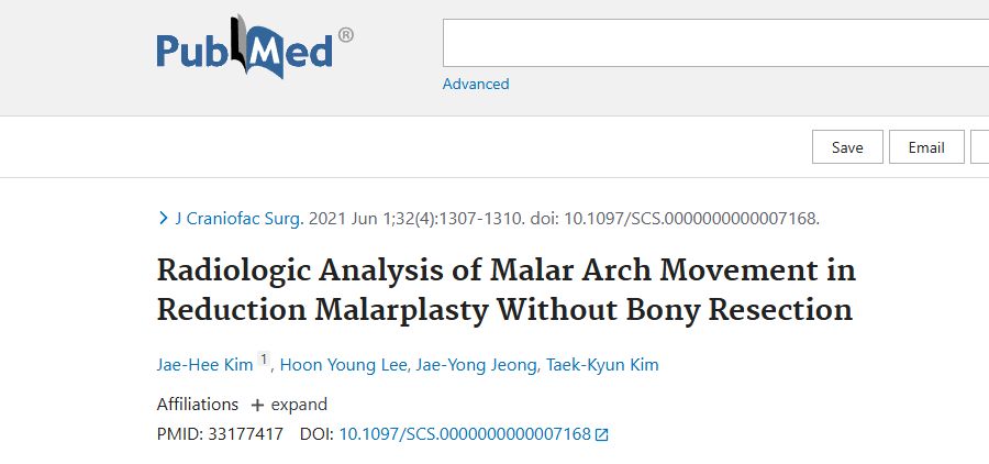 Radiologic Analysis of Malar Arch Movement in Reduction Malarplasty Without Bony Resection
