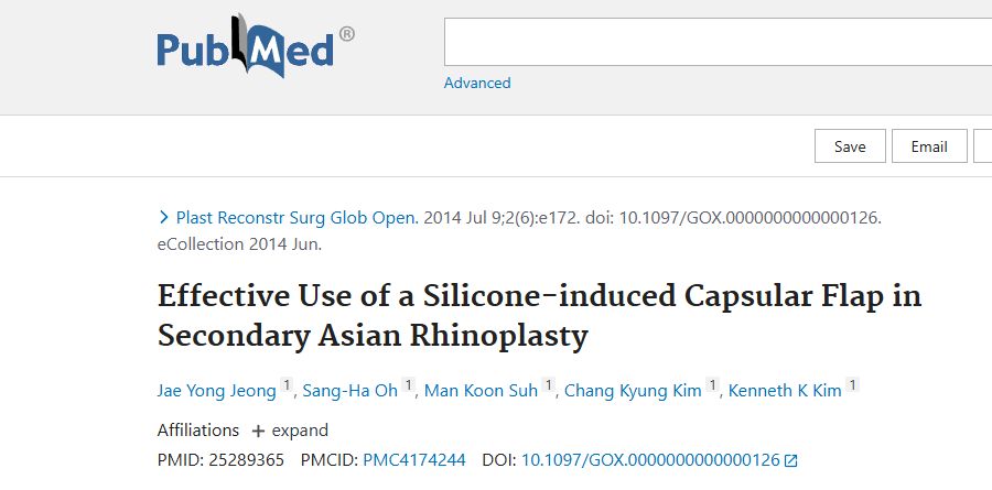 Effective Use of a Silicone-induced Capsular Flap in Secondary Asian Rhinoplasty